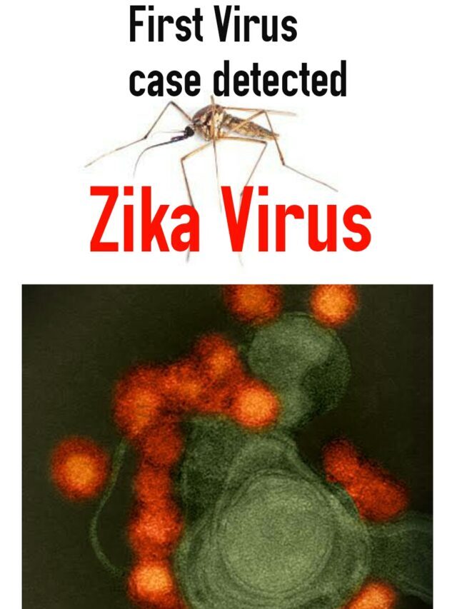 Zika Virus